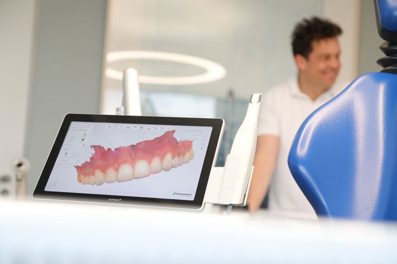 3D Abdrucknahme für Patienten mit Würgereiz